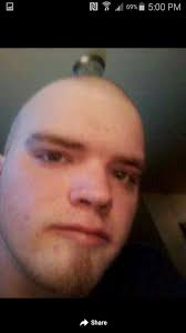 This is Benjamin Scott Tinney. He is 42 yes old. He has Spina Bifida and  has a prothesis