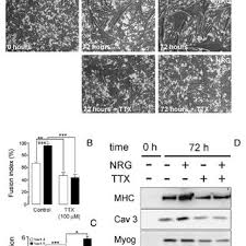 Art cache:87byrsbyhgyj:www infobiografias com/biografia/30046/keanu reeves html como se prepara la semilla de aguacate para abortar remedio cacero para quitar la teta pornodeinfantil mi bebé me tiene pelada el pico de la teta como se curar mi pico de la teta de forma natural testing%\' and 2*3*8=6*8. Pdf Voltage Dependent Na Channel Phenotype Changes In Myoblasts Consequences For Cardiac Repair