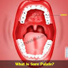 When i rub my tounge on across the roof of my mouth it feels like really tiny granules are up there. Https Encrypted Tbn0 Gstatic Com Images Q Tbn And9gcqtsjq4dcuouus9cy0xljdolo2dlwesa6o Vbenag5eocld3oki Usqp Cau