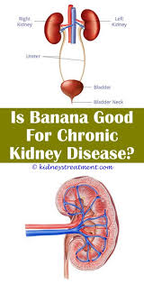 Kidney Disease Awareness Rheumatoid Arthritis Kidney Disease Chronic Kidney Disease Kidney Disease Symptoms