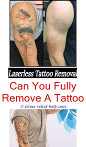 Do this 4 times a day and may take a few days to a month or more depending on you skin and the tattoo. Tattoo Removal Clinic Does Vaseline Remove Tattoo Ink Tattoo Removal Before And After Healing Tatto Eyebrow Tattoo Removal Tattoo Removal Tattoo Removal Cost
