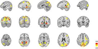 Rezultate admitere academia de poliție 2017. Functional Connectivity Dynamics During Film Viewing Reveal Common Networks For Different Emotional Experiences Springerlink