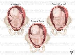 Image result for Compound Presentation