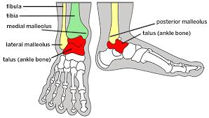 The foot bones shown in this diagram are the talus, navicular, cuneiform, cuboid, metatarsals and calcaneus. Broken Ankle Types Of Fractures Diagnosis Treatments