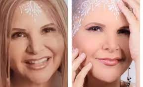 Diva Jessurum: ¿Qué tipo de cáncer tuvo y cómo fue su experiencia?