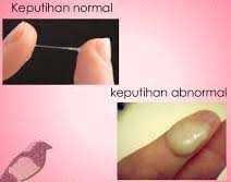 Maybe you would like to learn more about one of these? Cara Mengatasi Keputihan Bercampur Darah