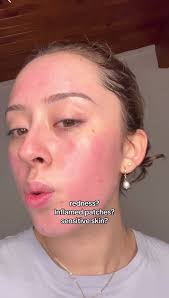 Bonded by Simplicity Patch