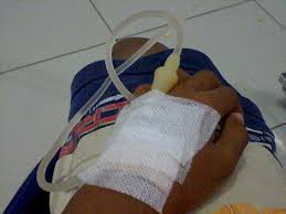 Gambar Orang Di Infus