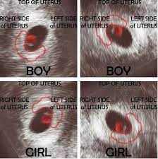 One of the most common ways to do this is with an ultrasound, most frequently performed at between 18 and 20 weeks of gestation. Pin On Awesome Baby Tips