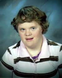 Is Your Home Influenced by Down Syndrome (Trisomey 21)?