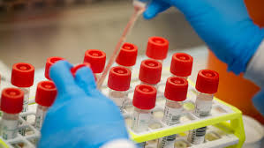 Reddit is the absolute fastest way to get answers to obscure question. 2 Cats Test Positive For Coronavirus Officials Recommend Precautions For Pets Extentworld