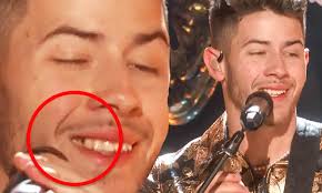 The following is the version of female idols. Nick Jonas Jokes After Performing With Food In His Teeth At Grammy Awards Daily Mail Online