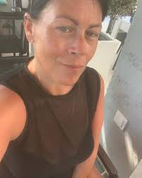 It's me in 2017 before all the botox and filler. I was so sick all the  time. I was 50lbs skinnier too. So weird to look back at this person.