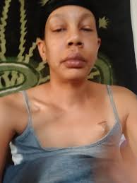 Has anyone had life return to normal after hard palate cancer?