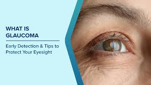 ग्लूकोमा क्या है: प्रारंभिक पहचान और अपनी दृष्टि की सुरक्षा के लिए सुझाव |  मैक्स हॉस्पिटल