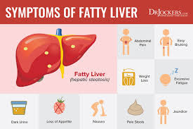 Fatty Liver Symptoms Causes And Natural Support Strategies Fatty Liver Fatty Liver Disease Symptoms Fatty Liver Disease