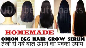 The yolk contains several components that could enrich the hair. Best Onion Egg Hair Regrowth Serum For Double Hair Growth Youtube