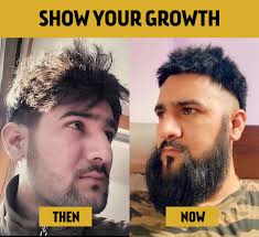 1,000,000 beards & growing 💸 affordable beard care products 🌱 healthy ingredients 🏅premium quality 👇join the club today! The Beard Club On Twitter Boom Another Rad Transformation And Entry Into The Club Transformationtuesday Showyourgrowth