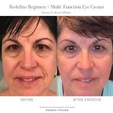 Best toxin free eye cream recommended