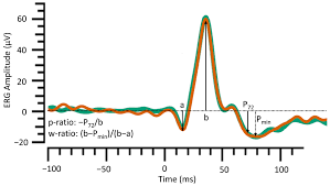 Heather small (born 20 january 1965) is an english soul singer, who was the lead singer of the band m people and later became a solo artist. Life Free Full Text Exploratory Study Of The Association Between The Severity Of Idiopathic Intracranial Hypertension And Electroretinogram Photopic Negative Response Amplitude Obtained Using A Handheld Device Html