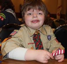 Cards for Jacob aims to cheer Cub Scout after major surgery