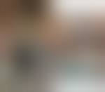 Image result for IDSA Diabetic Foot Wound Classification