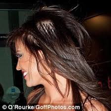 This tension can lead to traction alopecia, a type of alopecia caused when pressure is constantly put on the roots, damaging the hair follicles. Towie Jessica Wright Shows The Downfall Of Hair Extensions As She Steps Out With New Bald Patch Daily Mail Online