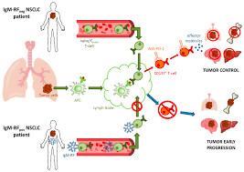 Image result for Rheumatoid Factor
