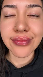 𝑳𝒊𝒑 𝒇𝒊𝒍𝒍𝒆𝒓 𝑷𝒍𝒆𝒂𝒔𝒆! 😍✨, $650 💕, Mayra Gamboa BSN , RN ✨, To  book call