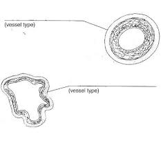 Exercise 32 Anatomy Of Blood Vessels Flashcards Easy