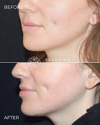 Saxon MD Facial Plastic...