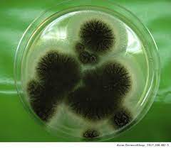 The fungi is most commonly found in mesophilic environments such as decaying vegetation or soil and plants. Proximal Subungual Onychomycosis Due To Aspergillus Niger A Simulator Of Subungual Malignant Melanoma Actas Dermo Sifiliograficas