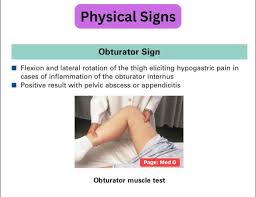 Image result for Obturator Sign