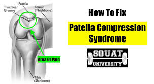 Image result for Patella Mobility Test
