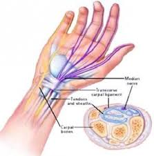 Pin On Juvenile Rheumatoid Arthritis