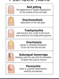 Image result for Pitting nails feet
