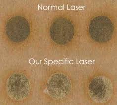 All skin types treated safely including our laser hair removal london expert practitioners are specially trained, qualified and insured to deliver the best possible results for all skin. Laser Hair Removal For Black Skin Leicester Laser Clinic