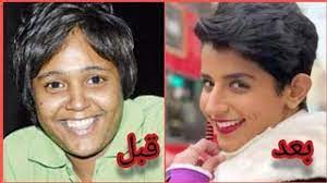 الكويتية نوره العميري قبل وبعد عمليات التجميل فرق شاسع لن تتخيل كم تغير شكلها youtube
