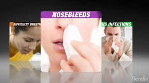 Nasal polyps can form throughout your sinuses or nasal passages, but most often are treatment. Nasal Sinus Surgery Augusta Aiken Ent Allergy