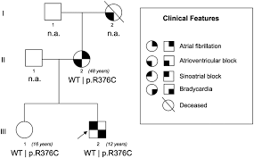 Genetic Analysis In A Family Affected By Sick Sinus Syndrome May Reduce The Sudden Death Risk In A Young Aspiring Competitive Athlete International Journal Of Cardiology
