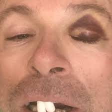 SAN FERNANDO DENTAL CARE