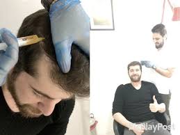 47 Begenme 3 Yorum Instagram Da Dr Nedim Yildiz Dr Nedimyildiz Sac Prp 2 Seans Prp Platellet Rich Plasma Yan Engagement Engagement Rings Fashion