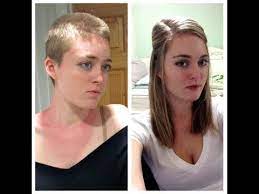 Creams and lotions that go on the surface of the skin. Hair Growth Time Lapse Love Meme