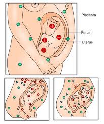 Pin On Nursing Ob Gyn