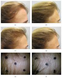 Figure 2 Hairstyles For Thin Hair Promotes Hair Growth Promote Hair