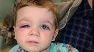When learning how to clean bath toys without bleach, vinegar is your go to option. Mom S Viral Warning On Tub Toys After Toddler S Terrifying Infection Gma