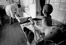 Young boys suffering from radiation sickness as a result of exposure to the. Midnight In Chernobyl The Untold Story Of The World S Greatest Nuclear Disaster By Adam Higginbotham