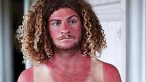 Prendre soin d'un visage qui récupère d'un coup de soleil éviter les coups de soleil sur le visage après avoir attrapé un coup de soleil, si vous avez de la fièvre, un mal de tête, la nausée. Coup De Soleil Sur Le Nez Que Faire Larry Remiszewski