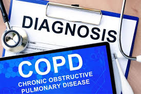 Image result for COPD Staging