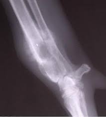 Unusual lumps or swellings anywhere on your cat's body, especially if they're getting larger or changing shape.; Osteosarcoma Animal Cancer And Imaging Center